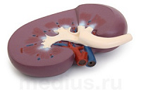 Модель почки в разрезе из пластика (лабораторная) – портал поставщиков НСППО
